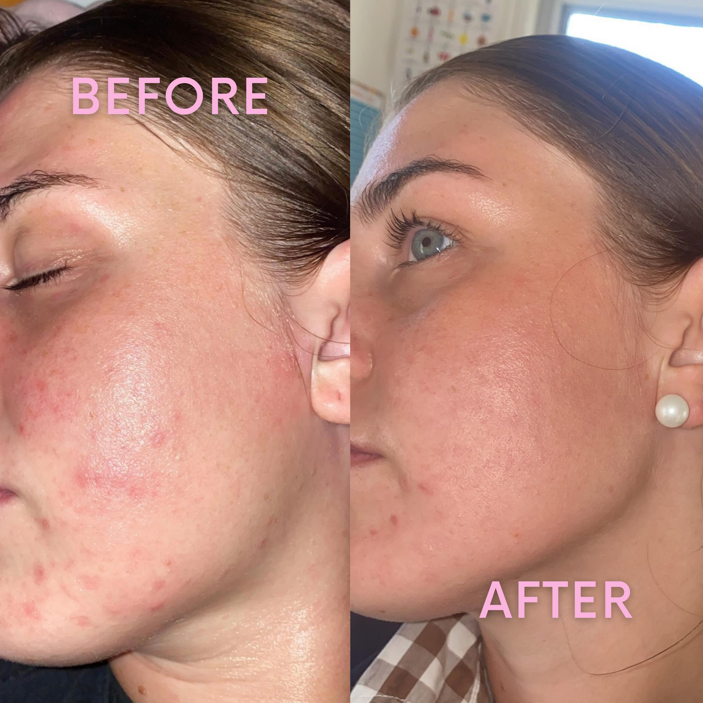 FRANKINCENSE- Whipped Tallow